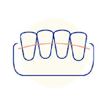 Invisalign